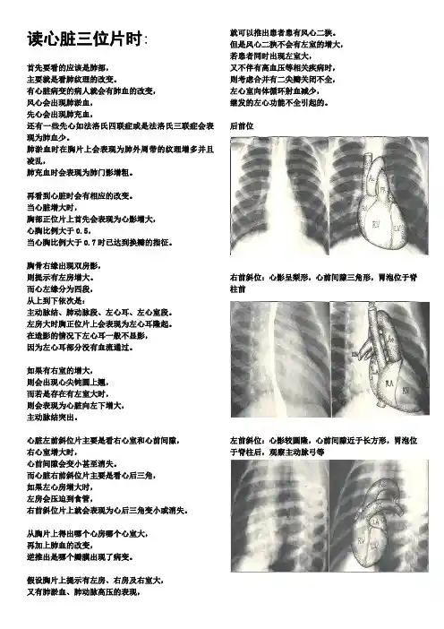 关于心脏三位片