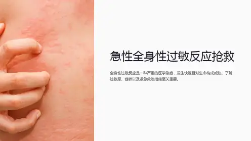 急性全身性过敏反应抢救