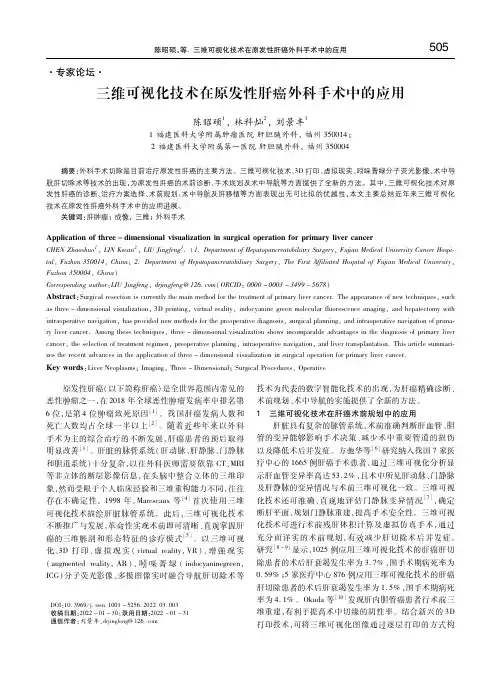 三维可视化技术在原发性肝癌外科手术中的应用