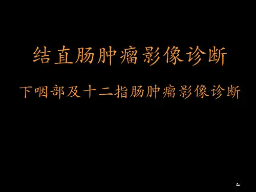 结直肠肿瘤影像诊断下咽部及十二指肠肿瘤影像诊断PPT课件