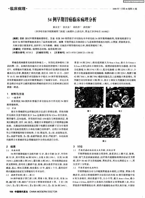 54例早期胃癌临床病理分析