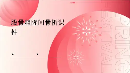 股骨粗隆间骨折课件