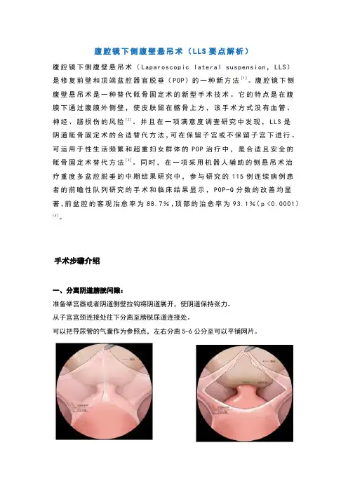 腹腔镜下侧腹壁悬吊术(LLS要点解析)