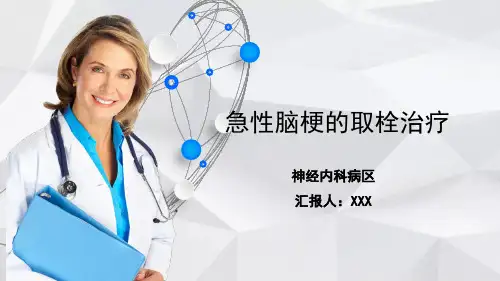 急性脑梗取栓治疗