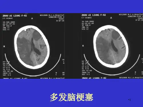 常见疾病的典型演示PPT