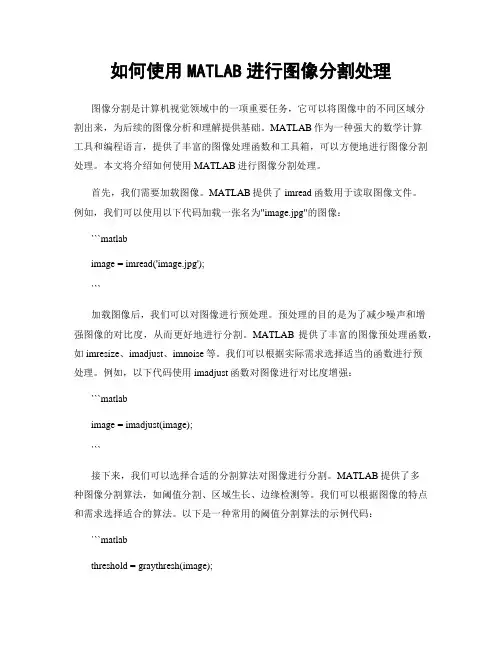 如何使用MATLAB进行图像分割处理