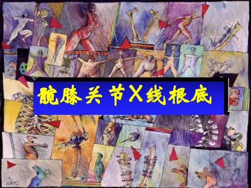 髋膝关节X线基ppt课件