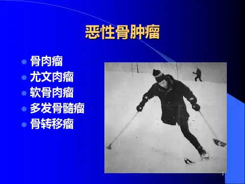 (推荐课件)常见骨肿瘤影像诊断分析PPT幻灯片
