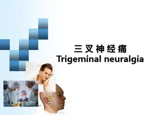 三叉神经痛ppt课件