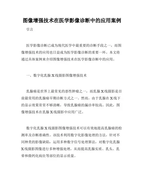 图像增强技术在医学影像诊断中的应用案例
