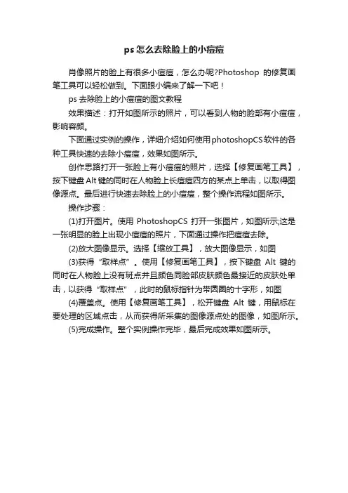 ps怎么去除脸上的小痘痘