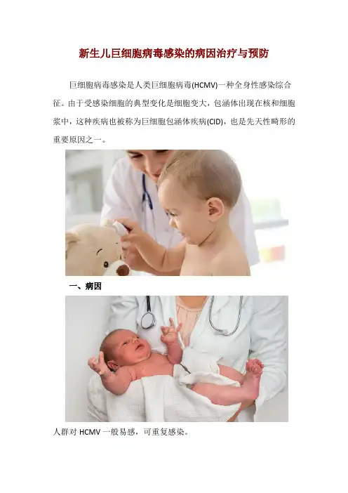 新生儿巨细胞病毒感染的病因治疗与预防