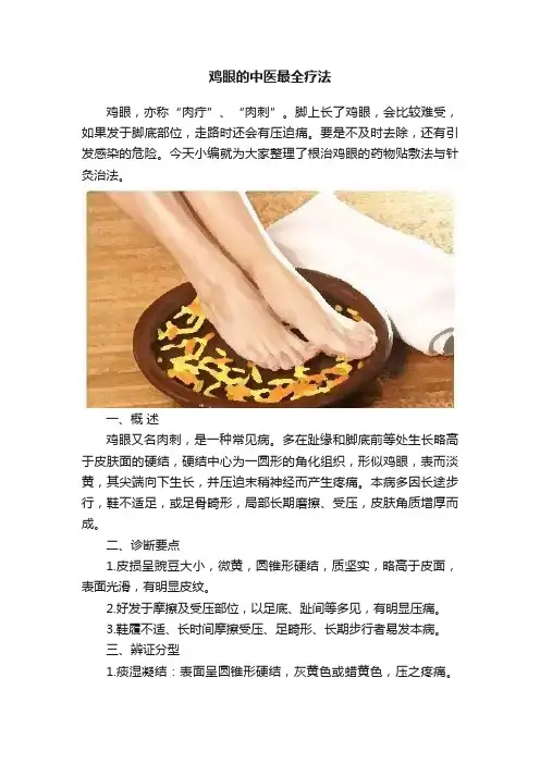 鸡眼的中医最全疗法