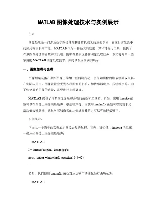 MATLAB图像处理技术与实例展示