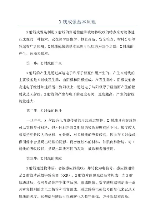 X线成像基本原理