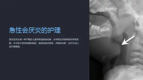 急性会厌炎的护理