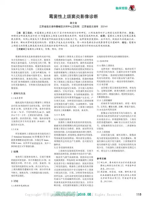 霉菌性上颌窦炎影像诊断