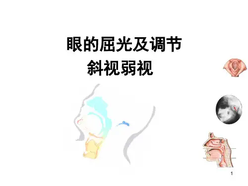 眼的屈光及调节ppt课件