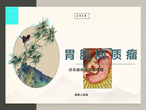 胃肠间质瘤(GIST)