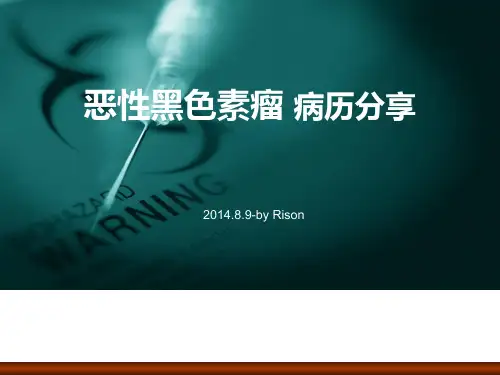 恶性黑色素瘤 病历分享 ppt课件