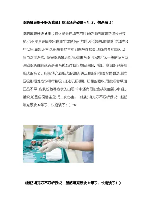 脂肪填充好不好听我说!脂肪填充硬块6年了,快崩溃了!