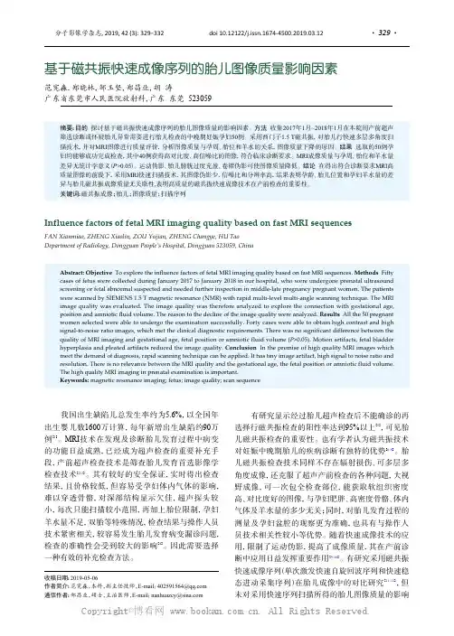 基于磁共振快速成像序列的胎儿图像质量影响因素