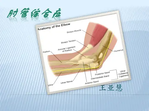 肘管综合症PPT