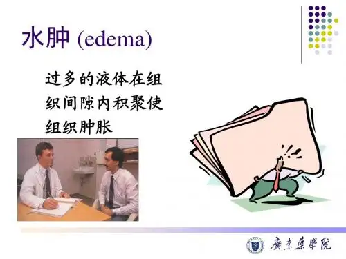 水肿