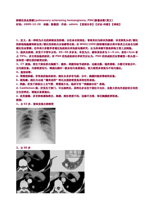 肺硬化性血管瘤(pulmonary sclerosing hemangioma, PSH)影像诊断(图文)