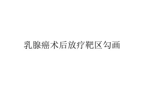 乳腺癌靶区勾画