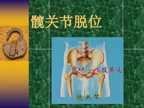 髋关节脱位课件PPT