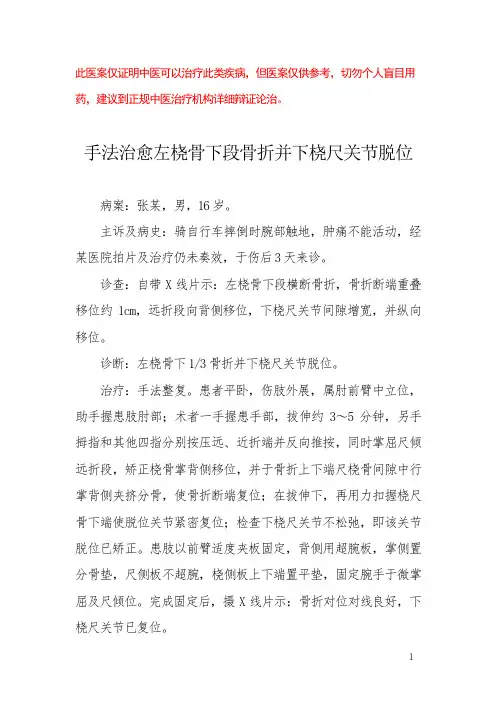 中医医案——左桡骨下段骨折并下桡尺关节脱位