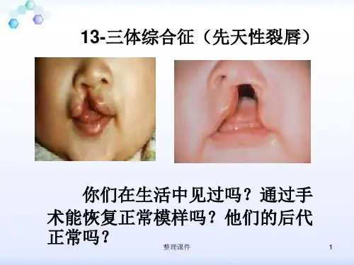 遗传病和优生优育课程