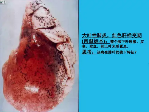 临床病理学病理图片