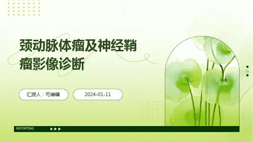 颈动脉体瘤及神经鞘瘤影像诊断PPT