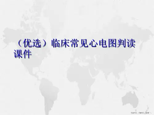 临床常见心电图判读详解