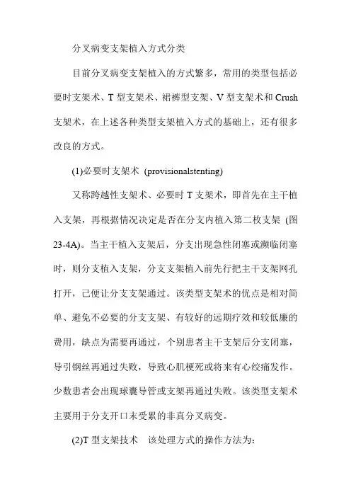分叉病变支架植入方式分类