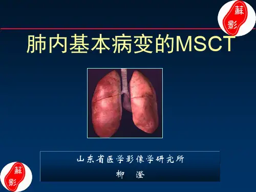 肺内基本病变的MSCT【胸部影像入门经典】