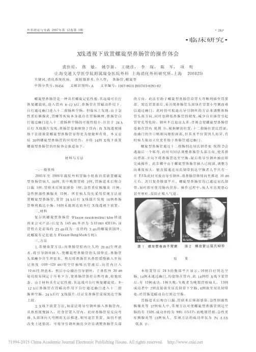 X线透视下放置螺旋型鼻肠管的操作体会_裘佳培