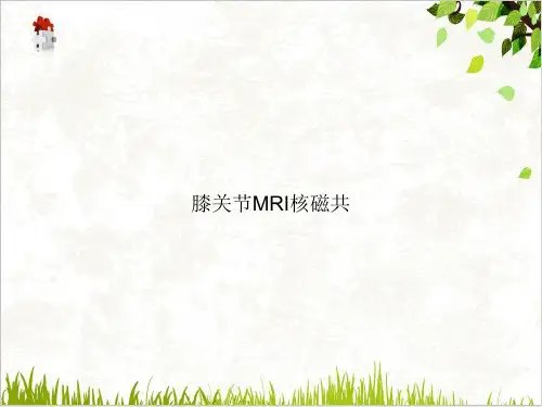 膝关节MRI核磁共PPT.