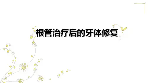 (完整版)根管治疗后的牙体修复