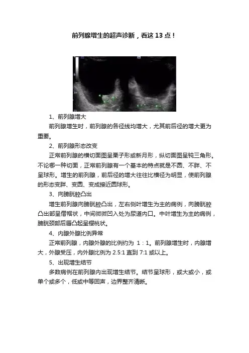 前列腺增生的超声诊断，看这13点！