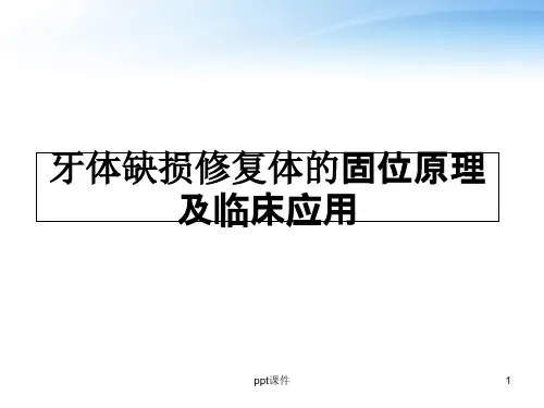 牙体缺损修复体的固位原理及临床应用  ppt课件