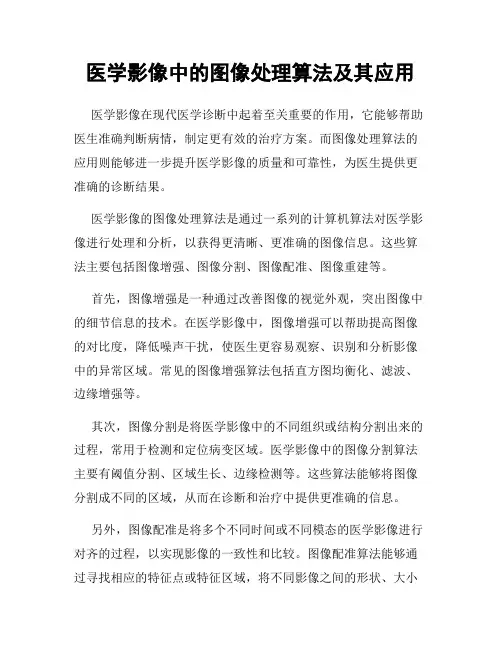 医学影像中的图像处理算法及其应用