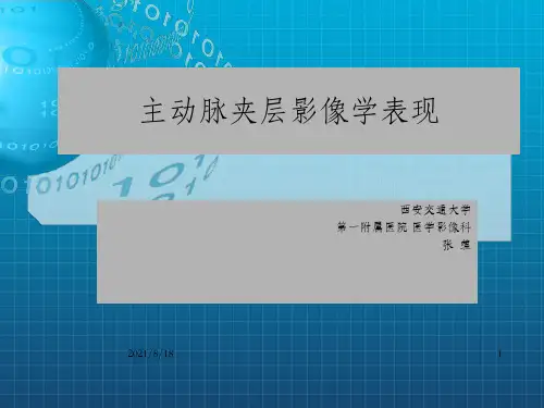 主动脉夹层影像学表现课件