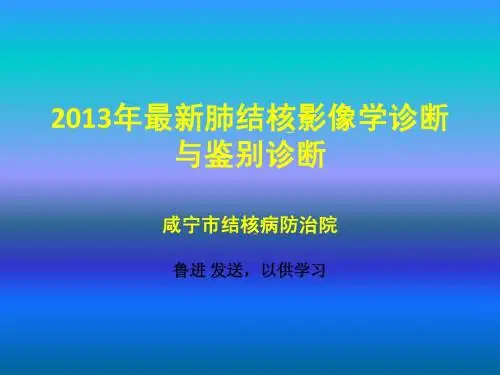 五、肺结核影像学的鉴别诊断2013.8