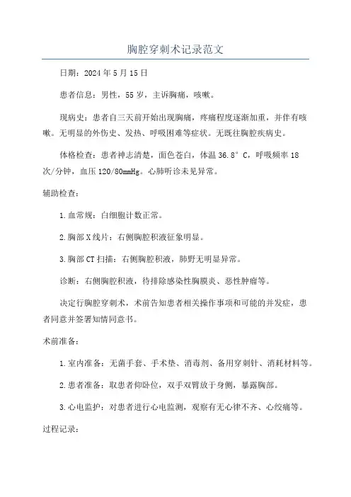 胸腔穿刺术记录范文