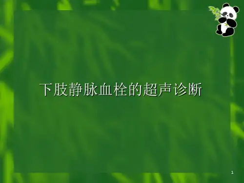 下肢静脉血栓的超声诊断ppt课件