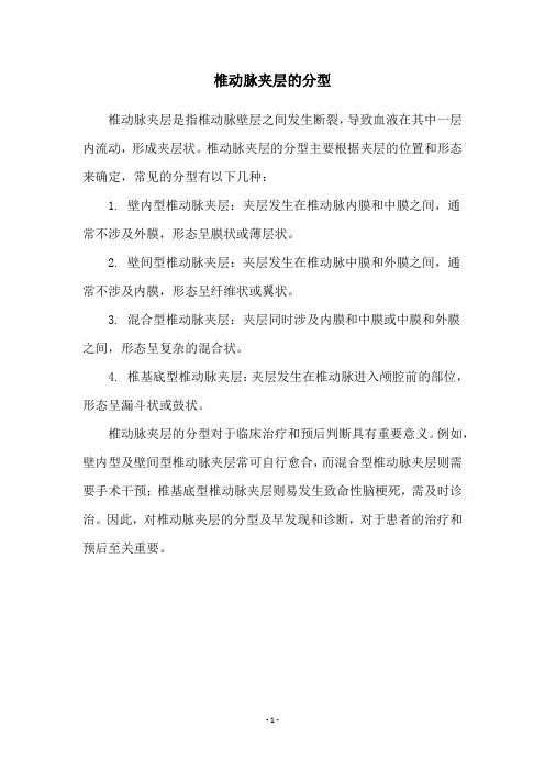 椎动脉夹层的分型