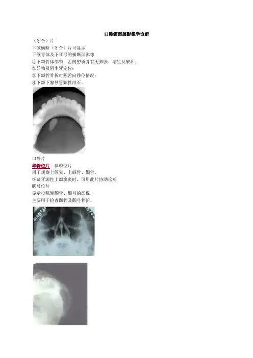 口腔颌面部影像学诊断重点